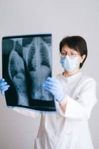 woman looking at x-rays