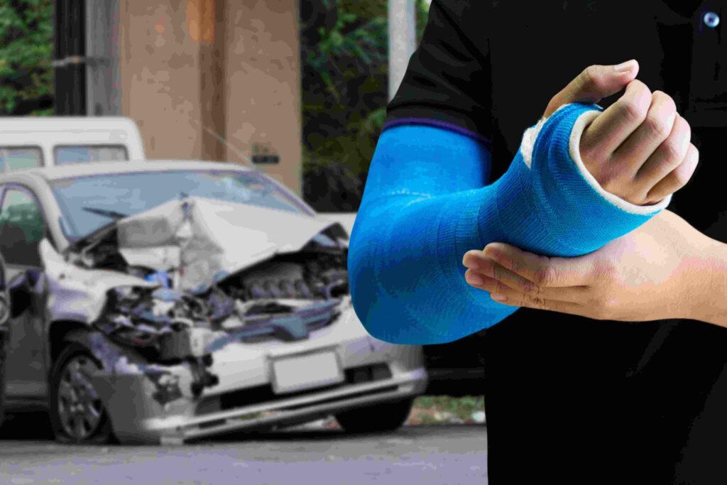 10 of the Most Common Injuries Seen After Seattle Car Accidents