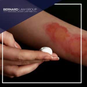 Seattle Burn Injury lawyers